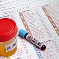 medical report and test containers to an analytical study